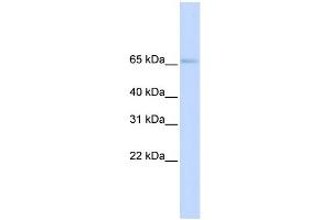 WB Suggested Anti-SLC22A6 Antibody Titration:  0. (SLC22A6 anticorps  (N-Term))