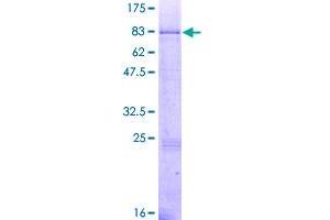 Image no. 1 for Mannosyl (Beta-1,4-)-Glycoprotein beta-1,4-N-Acetylglucosaminyltransferase (MGAT3) (AA 1-533) protein (GST tag) (ABIN1310823)