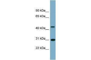 WB Suggested Anti-ARMCX3 Antibody Titration:  0. (ARMCX3 anticorps  (Middle Region))
