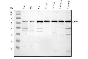 Western blot analysis of Calpain 2 using anti-Calpain 2 antibody (ABIN5518897). (Calpain 2 anticorps  (AA 500-700))