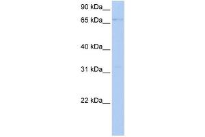 WB Suggested Anti-LSS Antibody Titration:  0. (LSS anticorps  (Middle Region))