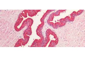Detection of PAP in Human Prostate Tissue using Polyclonal Antibody to Prostatic Acid Phosphatase (PAP) (ACPP anticorps  (AA 217-386))