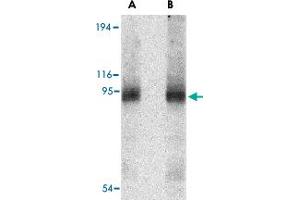 Western blot analysis of CD180 in human spleen tissue lysate with CD180 polyclonal antibody  at (A) 0. (CD180 anticorps  (Internal Region))