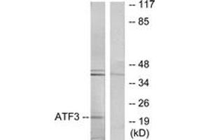 Western blot analysis of extracts from RAW264. (ATF3 anticorps  (AA 131-180))