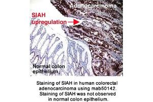 Image no. 2 for anti-Siah E3 Ubiquitin Protein Ligase 2 (SIAH2) (AA 1-100), (N-Term) antibody (ABIN363296)