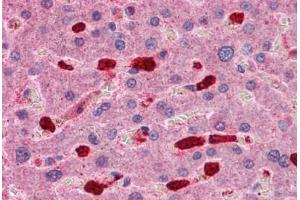 Human Liver: Formalin-Fixed, Paraffin-Embedded (FFPE) (ARHGAP18 anticorps  (C-Term))