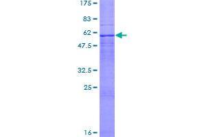 Image no. 1 for Tumor Suppressor Candidate 3 (TUSC3) (AA 1-347) protein (GST tag) (ABIN1324184)