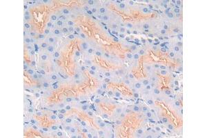 Used in DAB staining on fromalin fixed paraffin- embedded kidney tissue (SMPD2 anticorps  (AA 1-324))