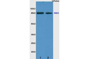 L1 human colon carcinoma lysates L2 rat kidney lysates probed with Anti ARHGAP24 Polyclonal Antibody, Unconjugated (ABIN714716) at 1:200 overnight at 4 °C. (ARHGAP24 anticorps  (AA 501-600))
