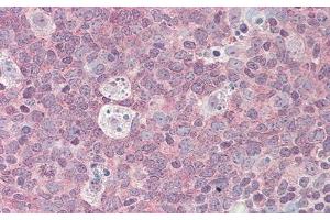 Detection of IL4R in Human Small Intestine Tissue using Polyclonal Antibody to Interleukin 4 Receptor (IL4R) (IL4 Receptor anticorps  (AA 26-233))