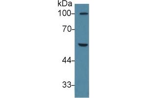 Detection of PPARg in Human K562 cell lysate using Polyclonal Antibody to Peroxisome Proliferator Activated Receptor Gamma (PPARg)