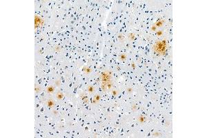Immunohistochemistry analysis of paraffin embedded mouse Alzheimer',s brainusing Aβ40 (ABIN7073042) at dilution of 1:400 (Abeta 1-40 anticorps)