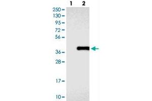 Western blot analysis of Lane 1: Negative control (vector only transfected HEK293T lysate), Lane 2: Over-expression Lysate (Co-expressed with a C-terminal myc-DDK tag (~3. (COLEC11 anticorps)