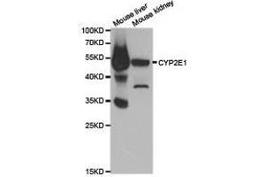 Western Blotting (WB) image for anti-Cytochrome P450, Family 2, Subfamily E, Polypeptide 1 (CYP2E1) antibody (ABIN1872172) (CYP2E1 anticorps)