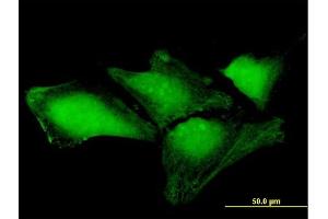 Immunofluorescence of purified MaxPab antibody to THAP4 on HeLa cell.