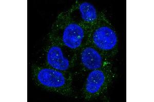 anti-ATG9 Autophagy Related 9 Homolog A (S. Cerevisiae) (ATG9A) antibody
