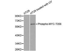 Western blot analysis of extracts from HT29 cells untreated or treated with UV, using phospho-MYC-T358 antibody. (c-MYC anticorps  (pThr358))