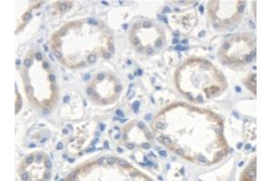 Detection of SCARA5 in Human Kidney Tissue using Polyclonal Antibody to Scavenger Receptor Class A Member 5 (SCARA5) (SCARA5 anticorps  (AA 118-495))