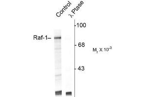 Image no. 1 for anti-V-Raf-1 Murine Leukemia Viral Oncogene Homolog 1 (RAF1) (pSer301) antibody (ABIN372711) (RAF1 anticorps  (pSer301))