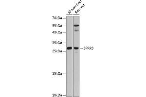 Western blot analysis of extracts of various cell lines, using SPRR3 antibody (ABIN6130714, ABIN6148386, ABIN6148387 and ABIN6215609) at 1:3000 dilution. (SPRR3 anticorps  (AA 1-70))