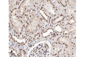 ABIN6279881 at 1/200 staining human kidney tissue sections by IHC-P. (TCEAL8 anticorps  (Internal Region))