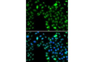Immunofluorescence analysis of MCF7 cell using ING5 antibody. (ING5 anticorps)