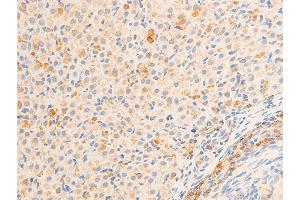 ABIN6267070 at 1/100 staining rat ovarian tissue sections by IHC-P.
