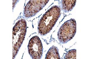 IHC analysis of DYNLT1 using anti-DYNLT1 antibody (ABIN5693148).