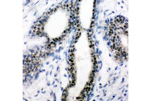 Immunohistochemistry (Paraffin-embedded Sections) (IHC (p)) image for anti-Estrogen Receptor 1 (ESR1) (AA 425-595) antibody (ABIN3042378)