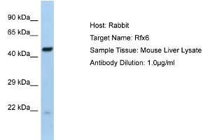 Host:  Rabbit  Target Name:  Rfx6  Sample Type:  Mouse Liver lysates  Antibody Dilution:  1. (RFX6 anticorps  (Middle Region))
