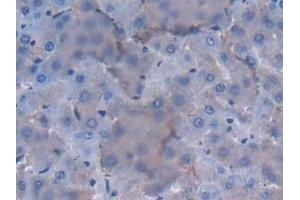 Detection of IL12A in Rat Liver Tissue using Polyclonal Antibody to Interleukin 12A (IL12A)