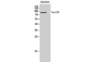Western Blotting (WB) image for anti-Sec23 Homolog B (SEC23B) (Internal Region) antibody (ABIN3177351) (Sec23 Homolog B anticorps  (Internal Region))