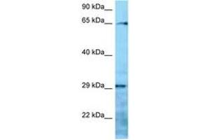 Image no. 1 for anti-Villin-Like (VILL) (AA 176-225) antibody (ABIN6748301) (VILL anticorps  (AA 176-225))