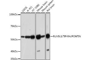 Western blot analysis of extracts of various cell lines, using RUVBL1/TIP49A/PONTIN Rabbit mAb (ABIN7270118) at 1:1000 dilution. (RUVBL1 anticorps)