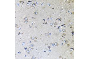 anti-Mediator of Cell Motility 1 (MEMO1) (AA 1-297) antibody