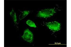 Immunofluorescence of purified MaxPab antibody to SQSTM1 on HeLa cell.