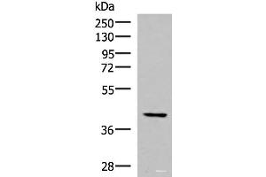Western blot analysis of Hela cell lysate using IST1 Polyclonal Antibody at dilution of 1:1000 (IST1 anticorps)