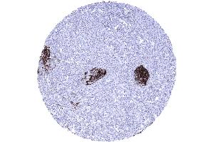 CD23 negative mantle cell lymphoma containing few germinal centre remnants that include CD23 positive dendritic cells
