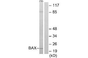 Immunohistochemistry analysis of paraffin-embedded human liver carcinoma tissue using BAX antibody.