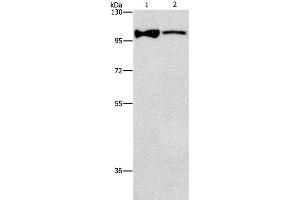 Western Blot analysis of Lovo cell and Human fetal brain tissue using ADCY3 Polyclonal Antibody at dilution of 1:312. (ADCY3 anticorps)
