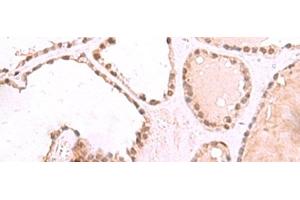 anti-RuvB-Like 1 (E. Coli) (RUVBL1) antibody