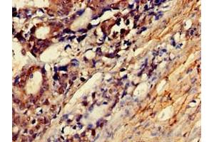 Immunohistochemistry of paraffin-embedded human smooth muscle tissue using ABIN7160538 at dilution of 1:100 (MYLK anticorps  (AA 290-398))