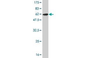 Western Blot detection against Immunogen (52. (CLIC1 anticorps  (AA 1-241))