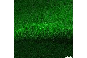 Indirect immunostaining PFA fixed hippocampus sections (dilution 1 : 500). (DLG3 anticorps)