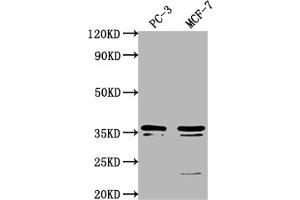 Western Blot Positive WB detected in: PC-3 whole cell lysate, MCF-7 whole cell lysate All lanes: OR6C1 antibody at 1:1000 Secondary Goat polyclonal to rabbit IgG at 1/50000 dilution Predicted band size: 36 kDa Observed band size: 36 kDa