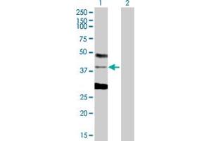 Western Blot analysis of CSDA expression in transfected 293T cell line by CSDA MaxPab polyclonal antibody. (CSDA anticorps  (AA 1-372))
