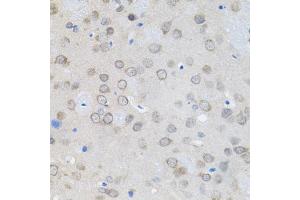 Immunohistochemistry of paraffin-embedded rat brain using UBE2A antibody (ABIN6132760, ABIN6149782, ABIN6149784 and ABIN6223686) (40x lens). (UBE2A anticorps  (AA 1-152))