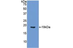 Western blot analysis of recombinant Human ANGPT1. (Angiopoietin 1 anticorps  (AA 284-452))