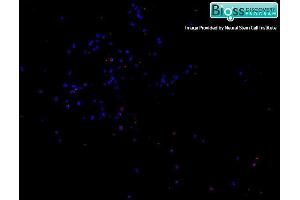 anti-SATB Homeobox 2 (SATB2) (AA 451-485) antibody