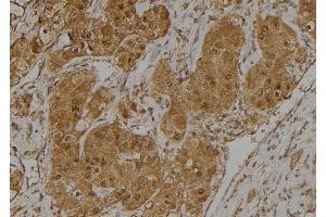 ABIN6275025 at 1/100 staining Human kidney tissue by IHC-P. (CCDC102B anticorps  (Internal Region))